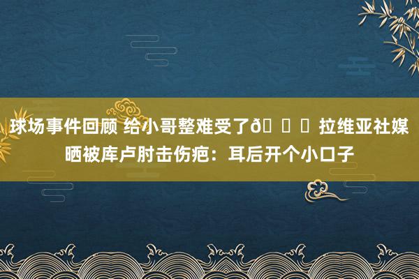 球场事件回顾 给小哥整难受了😅拉维亚社媒晒被库卢肘击伤疤：耳后开个小口子